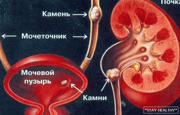 Диета за бъбрек на IBD